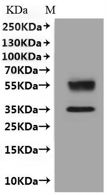 CSB-MP006256HU is detected by Mouse anti-6*His monoclonal antibody.
