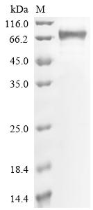 (Tris-Glycine gel) Discontinuous SDS-PAGE (reduced) with 5% enrichment gel and 15% separation gel. (Tris-Glycine gel) Discontinuous SDS-PAGE (reduced) with 5% enrichment gel and 15% separation gel.