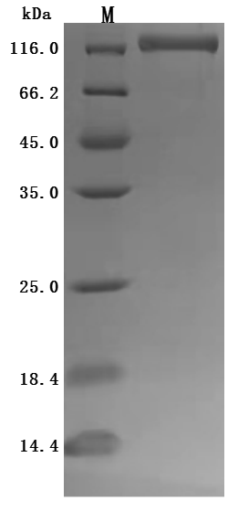 (Tris-Glycine gel) Discontinuous SDS-PAGE (reduced) with 5% enrichment gel and 15% separation gel. (Tris-Glycine gel) Discontinuous SDS-PAGE (reduced) with 5% enrichment gel and 15% separation gel.