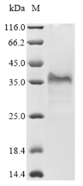 (Tris-Glycine gel) Discontinuous SDS-PAGE (reduced) with 5% enrichment gel and 15% separation gel. (Tris-Glycine gel) Discontinuous SDS-PAGE (reduced) with 5% enrichment gel and 15% separation gel.