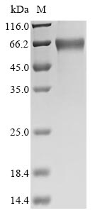 Recombinant Horse Erythropoietin (EPO) - image 1