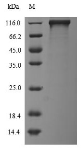 CSB-MP007765HU SDS-PAGE