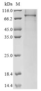 (Tris-Glycine gel) Discontinuous SDS-PAGE (reduced) with 5% enrichment gel and 15% separation gel. (Tris-Glycine gel) Discontinuous SDS-PAGE (reduced) with 5% enrichment gel and 15% separation gel.