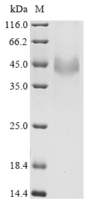 (Tris-Glycine gel) Discontinuous SDS-PAGE (reduced) with 5% enrichment gel and 15% separation gel. (Tris-Glycine gel) Discontinuous SDS-PAGE (reduced) with 5% enrichment gel and 15% separation gel.