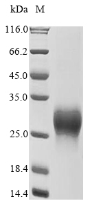 (Tris-Glycine gel) Discontinuous SDS-PAGE (reduced) with 5% enrichment gel and 15% separation gel. (Tris-Glycine gel) Discontinuous SDS-PAGE (reduced) with 5% enrichment gel and 15% separation gel.