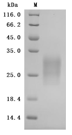 CSB-MP009438RA1 SDS-PAGE