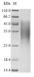 (Tris-Glycine gel) Discontinuous SDS-PAGE (reduced) with 5% enrichment gel and 15% separation gel. (Tris-Glycine gel) Discontinuous SDS-PAGE (reduced) with 5% enrichment gel and 15% separation gel.