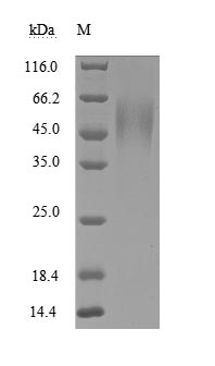 CSB-MP010958HU1 SDS-PAGE