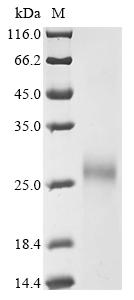 (Tris-Glycine gel) Discontinuous SDS-PAGE (reduced) with 5% enrichment gel and 15% separation gel. (Tris-Glycine gel) Discontinuous SDS-PAGE (reduced) with 5% enrichment gel and 15% separation gel.