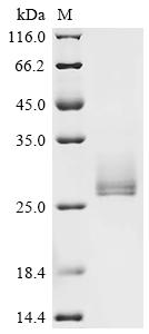 (Tris-Glycine gel) Discontinuous SDS-PAGE (reduced) with 5% enrichment gel and 15% separation gel. (Tris-Glycine gel) Discontinuous SDS-PAGE (reduced) with 5% enrichment gel and 15% separation gel.