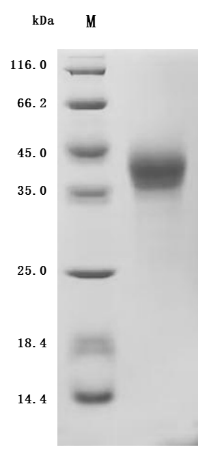 (Tris-Glycine gel) Discontinuous SDS-PAGE (reduced) with 5% enrichment gel and 15% separation gel.