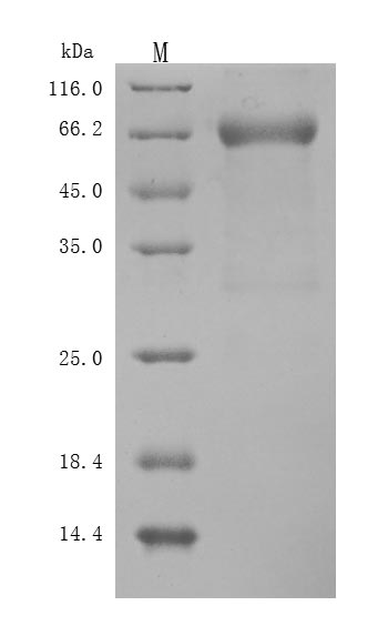 CSB-MP012928HUd9 SDS-PAGE