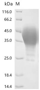 (Tris-Glycine gel) Discontinuous SDS-PAGE (reduced) with 5% enrichment gel and 15% separation gel.