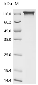 (Tris-Glycine gel) Discontinuous SDS-PAGE (reduced) with 5% enrichment gel and 15% separation gel.