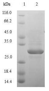 (Tris-Glycine gel) Discontinuous SDS-PAGE (reduced) with 5% enrichment gel and 15% separation gel. (Tris-Glycine gel) Discontinuous SDS-PAGE (reduced) with 5% enrichment gel and 15% separation gel.