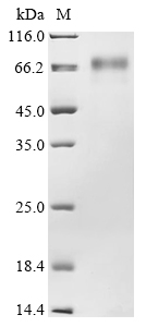 (Tris-Glycine gel) Discontinuous SDS-PAGE (reduced) with 5% enrichment gel and 15% separation gel. (Tris-Glycine gel) Discontinuous SDS-PAGE (reduced) with 5% enrichment gel and 15% separation gel.