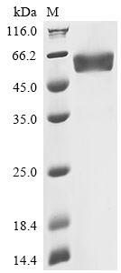 (Tris-Glycine gel) Discontinuous SDS-PAGE (reduced) with 5% enrichment gel and 15% separation gel. (Tris-Glycine gel) Discontinuous SDS-PAGE (reduced) with 5% enrichment gel and 15% separation gel.