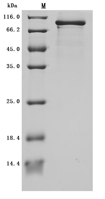 (Tris-Glycine gel) Discontinuous SDS-PAGE (reduced) with 5% enrichment gel and 15% separation gel. (Tris-Glycine gel) Discontinuous SDS-PAGE (reduced) with 5% enrichment gel and 15% separation gel.