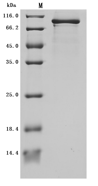 CSB-MP018222HU2k6 SDS-PAGE