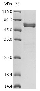(Tris-Glycine gel) Discontinuous SDS-PAGE (reduced) with 5% enrichment gel and 15% separation gel. (Tris-Glycine gel) Discontinuous SDS-PAGE (reduced) with 5% enrichment gel and 15% separation gel.