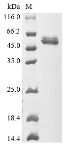 (Tris-Glycine gel) Discontinuous SDS-PAGE (reduced) with 5% enrichment gel and 15% separation gel.