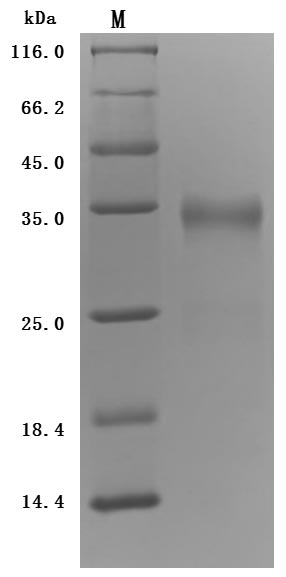 (Tris-Glycine gel) Discontinuous SDS-PAGE (reduced) with 5% enrichment gel and 15% separation gel.