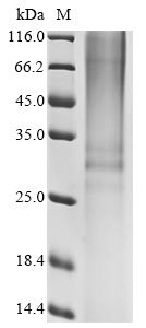 (Tris-Glycine gel) Discontinuous SDS-PAGE (reduced) with 5% enrichment gel and 15% separation gel. (Tris-Glycine gel) Discontinuous SDS-PAGE (reduced) with 5% enrichment gel and 15% separation gel.