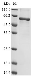 (Tris-Glycine gel) Discontinuous SDS-PAGE (reduced) with 5% enrichment gel and 15% separation gel. (Tris-Glycine gel) Discontinuous SDS-PAGE (reduced) with 5% enrichment gel and 15% separation gel.