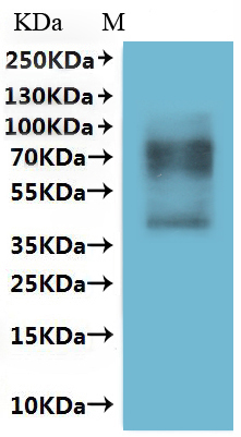 CSB-MP022724HU is detected by Mouse anti-6*His monoclonal antibody.