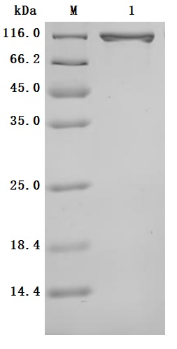 Human Serotransferrin(TF) Protein Purity Verified