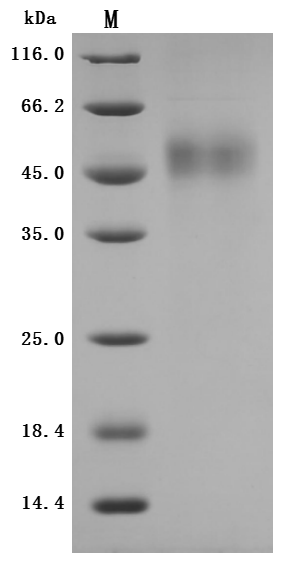 SDS-PAGE- Recombinant protein Rabbit TFPI