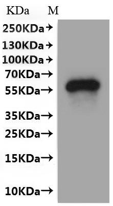CSB-MP023626HU(A4) is detected by Mouse anti-6*His monoclonal antibody.