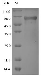 CSB-MP023977HU1 SDS-PAGE