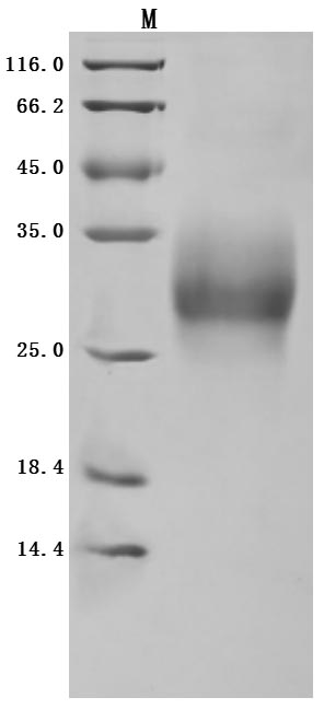 CSB-MP023984HU1 SDS-PAGE