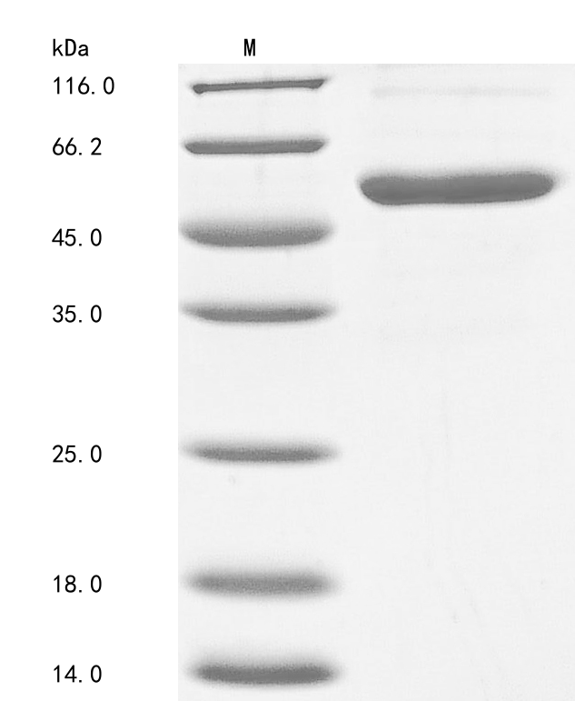 (Tris-Glycine gel) Discontinuous SDS-PAGE (reduced) with 5% enrichment gel and 15% separation gel. (Tris-Glycine gel) Discontinuous SDS-PAGE (reduced) with 5% enrichment gel and 15% separation gel.