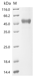 (Tris-Glycine gel) Discontinuous SDS-PAGE (reduced) with 5% enrichment gel and 15% separation gel.