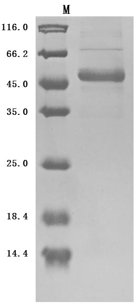 CSB-MP023997HU1 SDS-PAGE