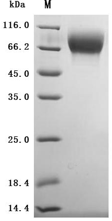 SDS-PAGE- Recombinant protein Macaca TPBG