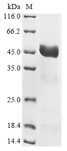 (Tris-Glycine gel) Discontinuous SDS-PAGE (reduced) with 5% enrichment gel and 15% separation gel. (Tris-Glycine gel) Discontinuous SDS-PAGE (reduced) with 5% enrichment gel and 15% separation gel.