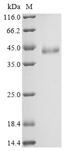 (Tris-Glycine gel) Discontinuous SDS-PAGE (reduced) with 5% enrichment gel and 15% separation gel.
