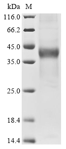 (Tris-Glycine gel) Discontinuous SDS-PAGE (reduced) with 5% enrichment gel and 15% separation gel. (Tris-Glycine gel) Discontinuous SDS-PAGE (reduced) with 5% enrichment gel and 15% separation gel.