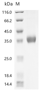 (Tris-Glycine gel) Discontinuous SDS-PAGE (reduced) with 5% enrichment gel and 15% separation gel.