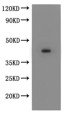 CSB-MP2709MOV is detected by Mouse anti-6*His monoclonal antibody.