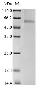 (Tris-Glycine gel) Discontinuous SDS-PAGE (reduced) with 5% enrichment gel and 15% separation gel. (Tris-Glycine gel) Discontinuous SDS-PAGE (reduced) with 5% enrichment gel and 15% separation gel.