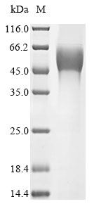 (Tris-Glycine gel) Discontinuous SDS-PAGE (reduced) with 5% enrichment gel and 15% separation gel. (Tris-Glycine gel) Discontinuous SDS-PAGE (reduced) with 5% enrichment gel and 15% separation gel.