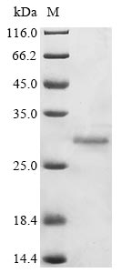 (Tris-Glycine gel) Discontinuous SDS-PAGE (reduced) with 5% enrichment gel and 15% separation gel. (Tris-Glycine gel) Discontinuous SDS-PAGE (reduced) with 5% enrichment gel and 15% separation gel.
