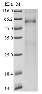 Recombinant Avian infectious bronchitis virus Nucleoprotein (N) - image 1