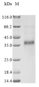 (Tris-Glycine gel) Discontinuous SDS-PAGE (reduced) with 5% enrichment gel and 15% separation gel. (Tris-Glycine gel) Discontinuous SDS-PAGE (reduced) with 5% enrichment gel and 15% separation gel.