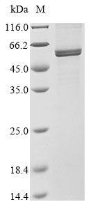 (Tris-Glycine gel) Discontinuous SDS-PAGE (reduced) with 5% enrichment gel and 15% separation gel. (Tris-Glycine gel) Discontinuous SDS-PAGE (reduced) with 5% enrichment gel and 15% separation gel.
