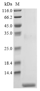 (Tris-Glycine gel) Discontinuous SDS-PAGE (reduced) with 5% enrichment gel and 15% separation gel. (Tris-Glycine gel) Discontinuous SDS-PAGE (reduced) with 5% enrichment gel and 15% separation gel.